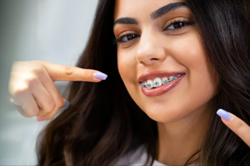 Woman pointing to her braces while smiling.
