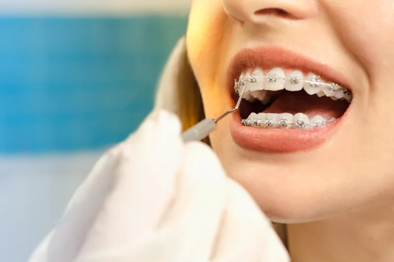 Orthodontist checking a patient's brackets.