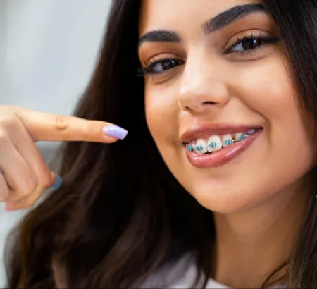 Woman pointing to her braces while smiling.