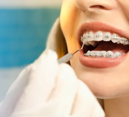 Orthodontist checking a patient's brackets.