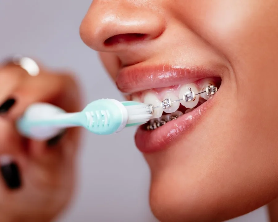 Woman with metal braces brushing their teeth.