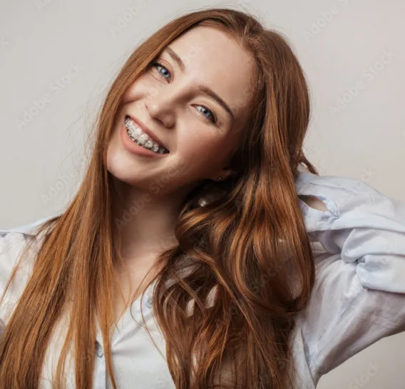 Woman smiling with ceramic braces