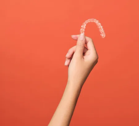 Clear Aligners
